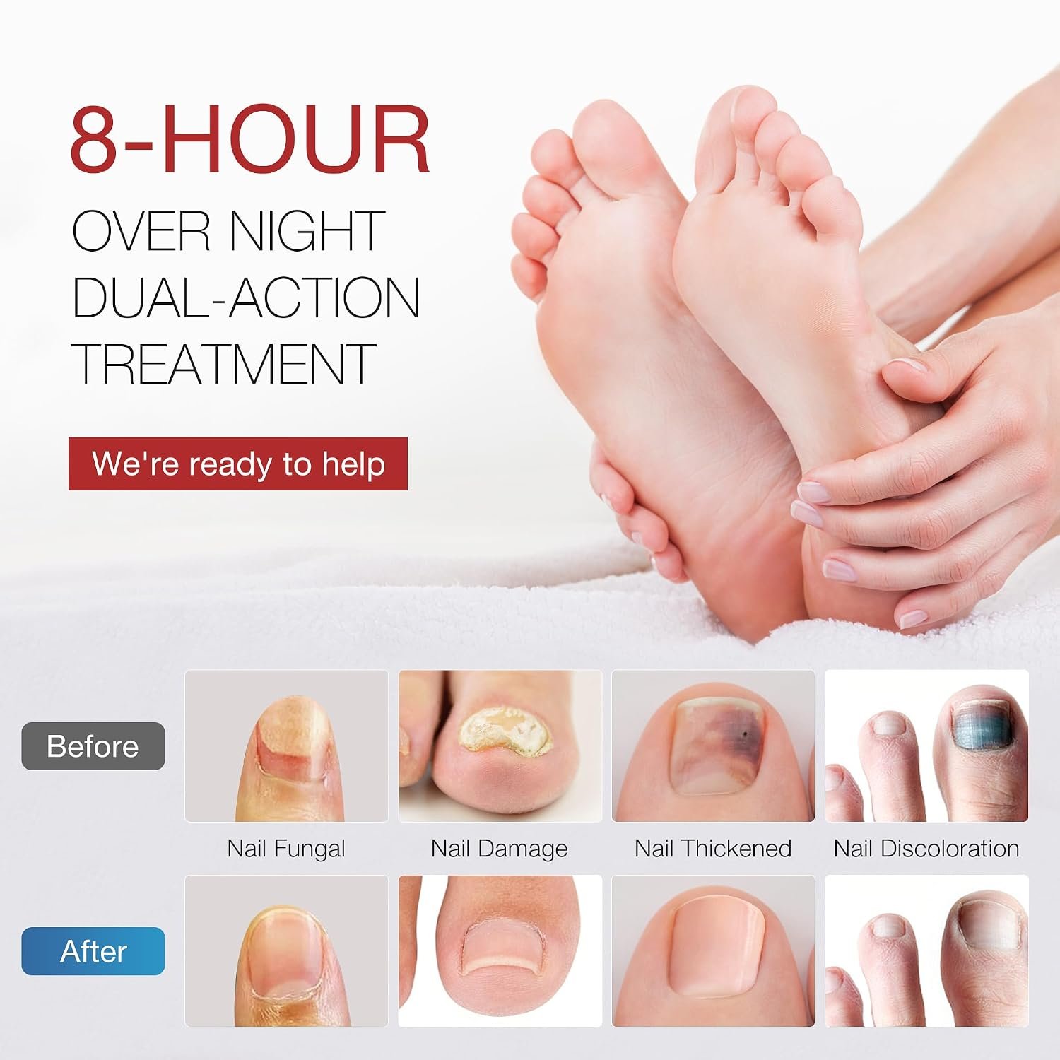 Toenail Fungus Treatment Extra Strength - DR.RAPID Toenail Fungus Treatment Pen & Fungal Nail Patches, Day and Night Fungal Nail Treatment Set, Ideal for Nail Repair for Damaged Nails Toenail Fungus - Image 5