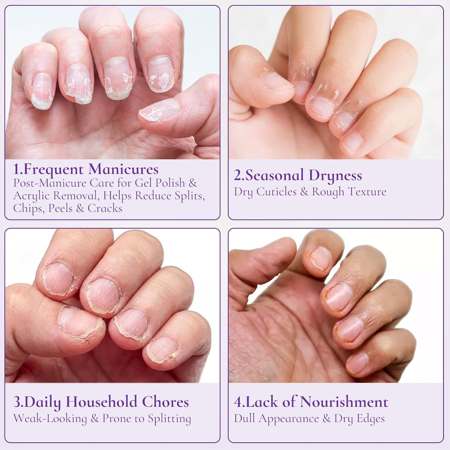 Nail & Cuticle Cream with Keratin Biotin Ceramides | Non-Greasy Cuticle Moisturizer for Dry Cracked Cuticles, Daily Nail Care After Manicures, 0.5 Fl Oz, Pack of 2 - Image 6