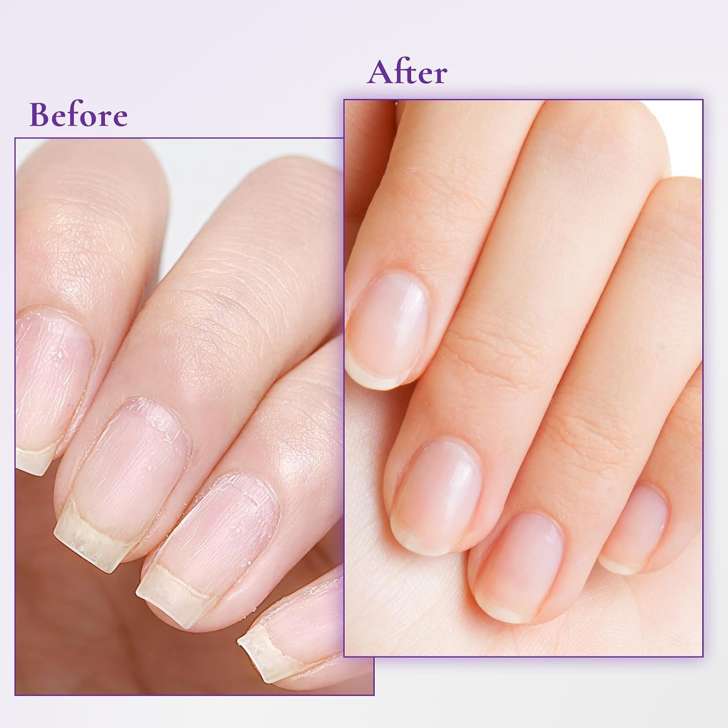 Nail & Cuticle Cream with Keratin Biotin Ceramides | Non-Greasy Cuticle Moisturizer for Dry Cracked Cuticles, Daily Nail Care After Manicures, 0.5 Fl Oz, Pack of 2 - Image 7