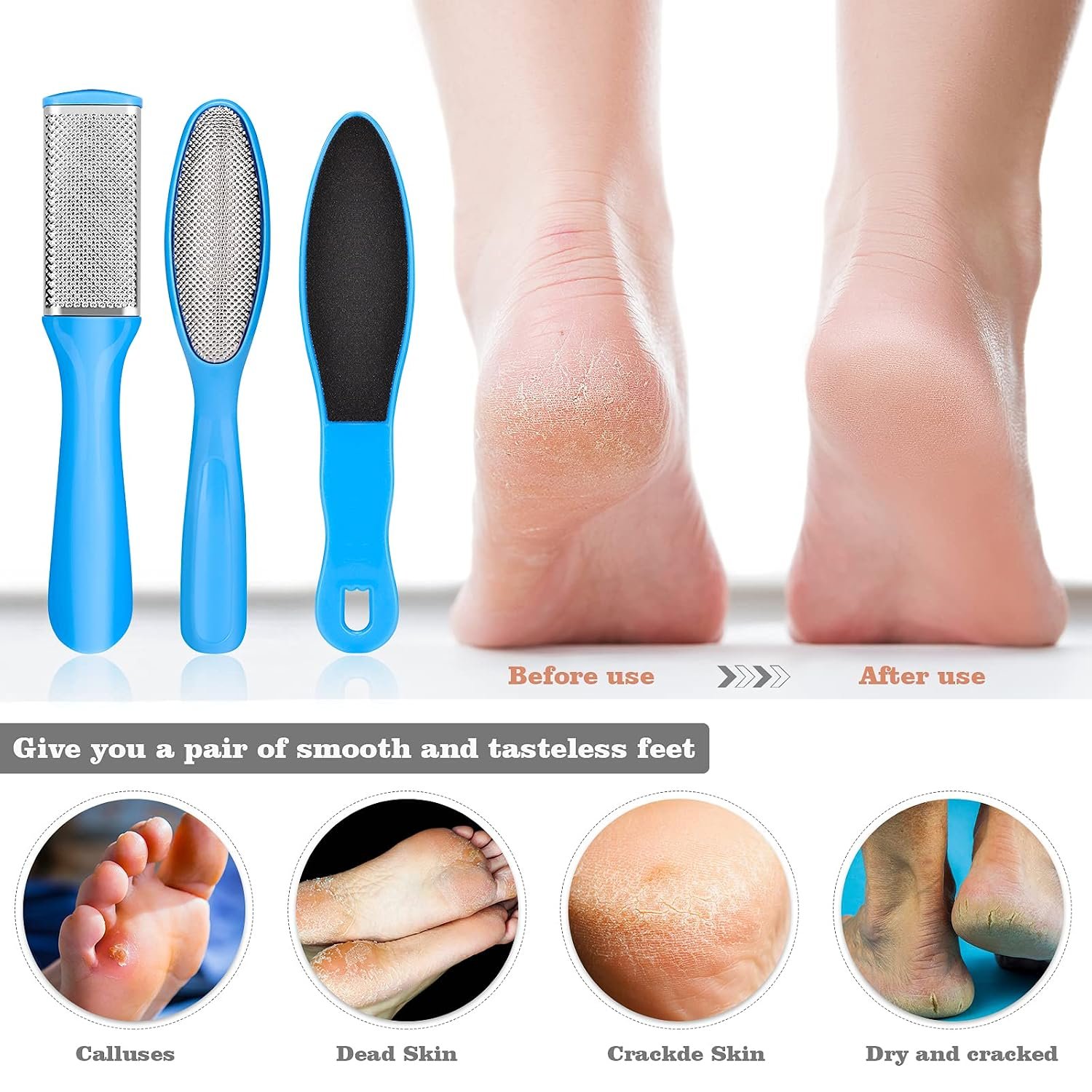 Pedicure Kits - Callus Remover for Feet, 23 in 1 Professional Manicure Set Pedicure Tools Stainless Steel Foot Care, Foot File Foot Rasp Dead Skin for Women Men Home Foot Spa Kit, Blue23 - Image 5