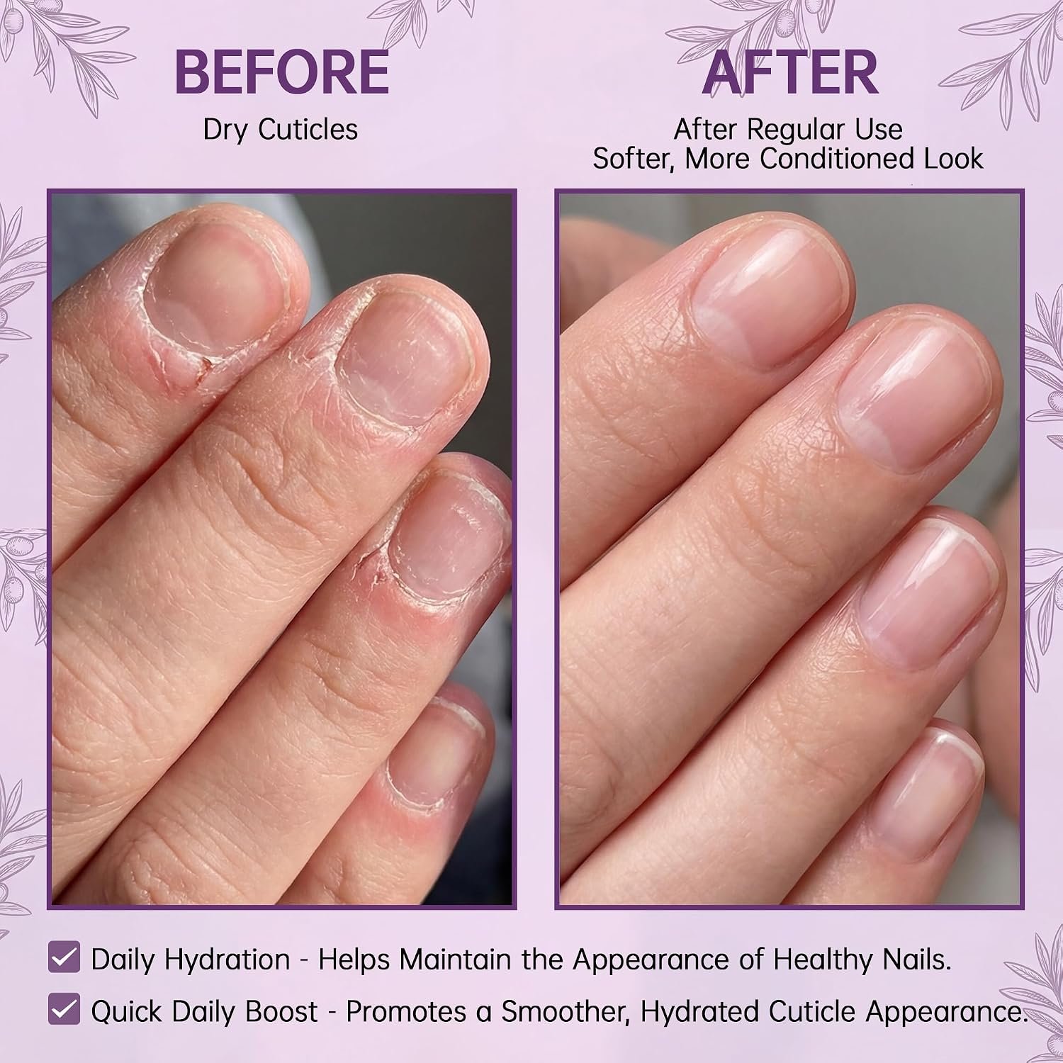 Cuticle Oil for Dry Cracked Cuticles, Cuticle Oil Pen | Hydrating Nail Moisturizer with Jojoba Oil, Vitamin E, Tea Tree & Squalane, Portable Brush Pen for Nails 15ml (Pack of 2) - Image 4