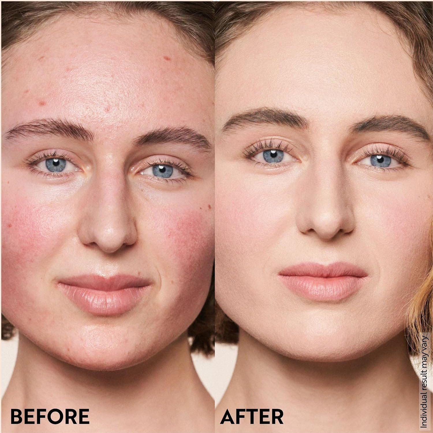 M. Asam Magic Finish Porcelain Teint Make-up Mousse (1.01 Fl Oz) | 4in1 Primer, Foundation, Concealer & Powder With Buildable Coverage, Adapts To Fair Skin Tones, Leaves Skin Looking Flawless - Image 11