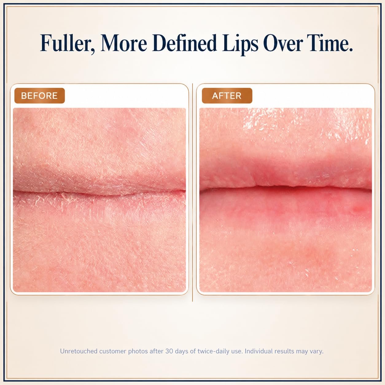 Osmotics Blue Copper 5 Lip Plumper – Hyaluronic Lip Plumping Treatment for Fuller-Looking Lips, Volume, Definition & Lasting Hydration, Copper Peptide Lip Care for Thin, Aging Lips, 0.17oz - Image 4